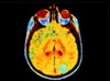 brainimage_thumb.jpg